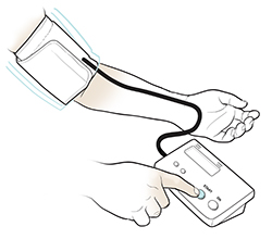 Braccio appoggiato sul tavolo con bracciale per la pressione sanguigna applicato alla parte superiore del braccio. L'altra mano preme il pulsante di avvio del misuratore per la pressione sanguigna.